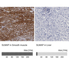 Anti-SLMAP Antibody