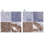Immunohistochemical staining of human liver, lymph node, smooth muscle and testis using Anti-SLMAP antibody HPA002358 (A) shows similar protein distribution across tissues to independent antibody HPA002357 (B).
