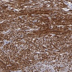 Anti-SLMAP Antibody