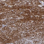 Immunohistochemical staining of human smooth muscle shows high expression.