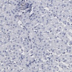 Anti-SLMAP Antibody