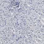 Immunohistochemical staining of human liver shows low expression as expected.