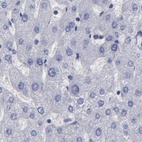 Anti-SLMAP Antibody