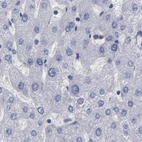Immunohistochemical staining of human liver using Anti-SLMAP antibody HPA002358.