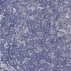 Immunohistochemical staining of human lymph node using Anti-SLMAP antibody HPA002358.