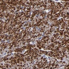 Immunohistochemical staining of human smooth muscle using Anti-SLMAP antibody HPA002358.