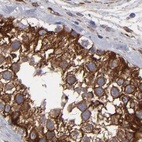 Anti-SLMAP Antibody