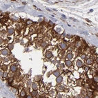 Immunohistochemical staining of human testis using Anti-SLMAP antibody HPA002358.
