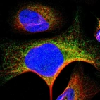 Immunofluorescent staining of human cell line U-2 OS shows localization to endoplasmic reticulum.