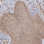 Immunohistochemical staining of human skin shows moderate cytoplasmic positivity in squamous epithelial cells.