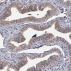 Immunohistochemical staining of human fallopian tube shows moderate cytoplasmic positivity in glandular cells.
