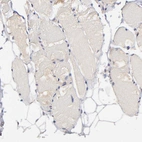 Immunohistochemical staining of human skeletal muscle shows no positivity in myocytes as expected.