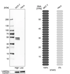 Western blot analysis in human cell lines MCF-7 and HeLa using Anti-STAP2 antibody. Corresponding STAP2 RNA-seq data are presented for the same cell lines. Loading control: Anti-HSP90B1.