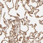 Anti-DPYSL2 Antibody