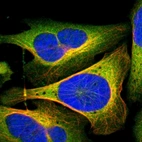 Immunofluorescent staining of human cell line U-2 OS shows localization to plasma membrane & cytosol.