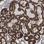 Anti-CDC34 Antibody