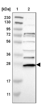 Lane 1: Marker [kDa] 230, 130, 95, 72, 56, 36, 28, 17, 11_br/_Lane 2: Human cell line RT-4
