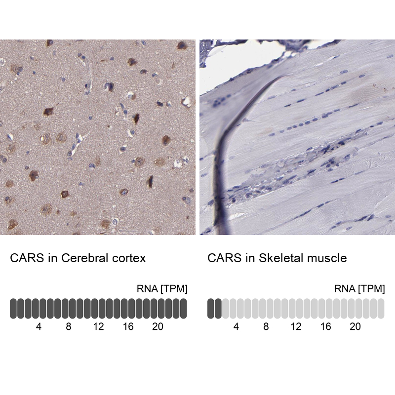 Anti-CARS Antibody