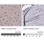 Anti-CARS Antibody