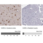 Immunohistochemistry analysis in human cerebral cortex and skeletal muscle tissues using HPA002383 antibody. Corresponding CARS RNA-seq data are presented for the same tissues.