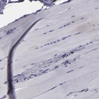 Immunohistochemical staining of human skeletal muscle shows low expression as expected.