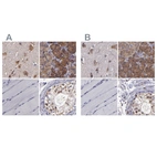 Immunohistochemical staining of human cerebral cortex, pancreas, skeletal muscle and testis using Anti-CARS antibody HPA002383 (A) shows similar protein distribution across tissues to independent antibody HPA002384 (B).