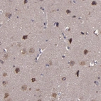 Immunohistochemical staining of human cerebral cortex shows high expression.
