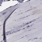 Immunohistochemical staining of human skeletal muscle shows low expression as expected.