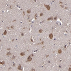 Immunohistochemical staining of human cerebral cortex shows strong cytoplasmic positivity in neuronal cells.