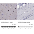 Anti-CARS Antibody