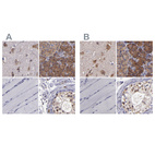 Immunohistochemical staining of human cerebral cortex, pancreas, skeletal muscle and testis using Anti-CARS antibody HPA002384 (A) shows similar protein distribution across tissues to independent antibody HPA002383 (B).