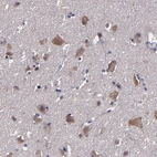 Immunohistochemical staining of human cerebral cortex shows strong cytoplasmic positivity in neuronal cells.