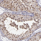 Immunohistochemical staining of human testis shows strong cytoplasmic positivity in cells in seminiferous ducts.