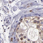 Immunohistochemical staining of human testis using Anti-CARS antibody HPA002384.