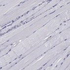 Immunohistochemical staining of human skeletal muscle shows no cytoplasmic positivity in myocytes as expected.