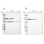 Western blot analysis using Anti-CARS antibody HPA002384 (A) shows similar pattern to independent antibody HPA002383 (B).