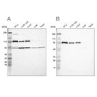 Western blot analysis using Anti-CARS antibody HPA002384 (A) shows similar pattern to independent antibody HPA002383 (B).
