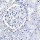 Anti-PSD3 Antibody