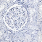 Anti-PSD3 Antibody