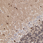 Immunohistochemical staining of human cerebellum shows strong cytoplasmic positivity in cells in molecular layer.
