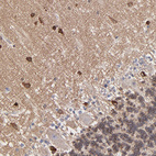 Anti-PSD3 Antibody