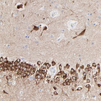 Immunohistochemical staining of human hippocampus shows strong cytoplasmic positivity in neurons.