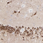 Immunohistochemical staining of human hippocampus shows strong cytoplasmic positivity in neurons.