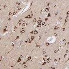 Immunohistochemical staining of human cerebral cortex shows strong cytoplasmic positivity in neurons.