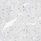 Immunohistochemical staining of human skeletal muscle shows no positivity in myocytes as expected.