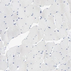Immunohistochemical staining of human skeletal muscle shows no positivity in myocytes as expected.