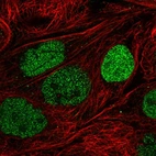 Immunofluorescent staining of human cell line A-431 shows localization to nucleus & vesicles.