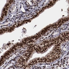 Immunohistochemical staining of human fallopian tube shows strong nuclear positivity in glandular cells.