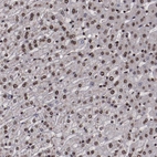 Immunohistochemical staining of human liver shows strong nuclear positivity in hepatocytes.