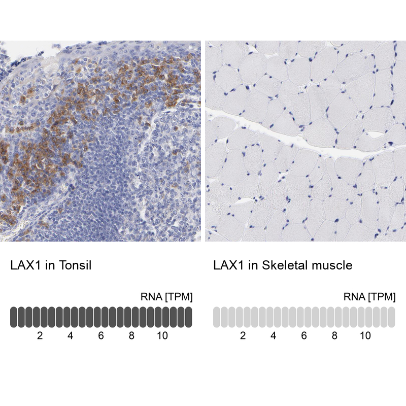Anti-LAX1 Antibody
